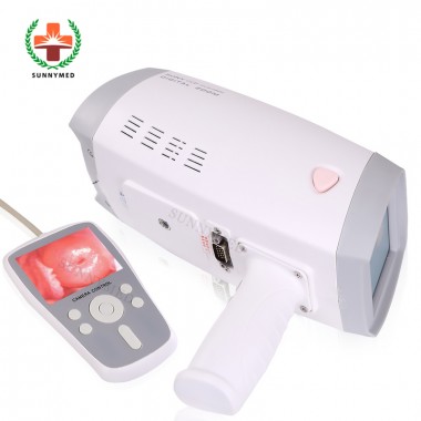 SY-F005 hospital digital colposcope machine handheld electronic colposcopy