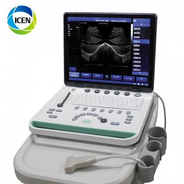 IN-A032-2 ICEN Portable Digital B Ultrasound Scanner Pregnancy Equipment Price